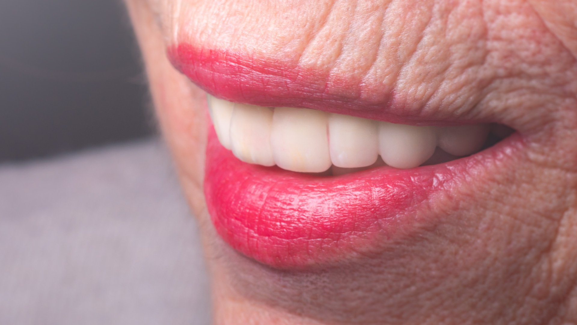 impianto dentale fisso