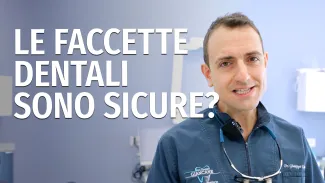 Faccette Dentali